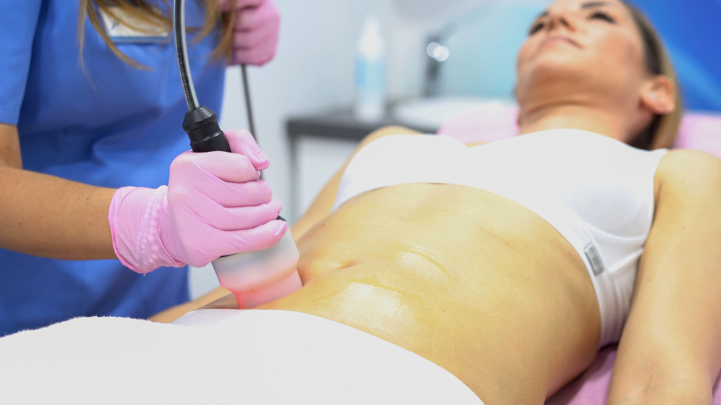Tummy Tuck