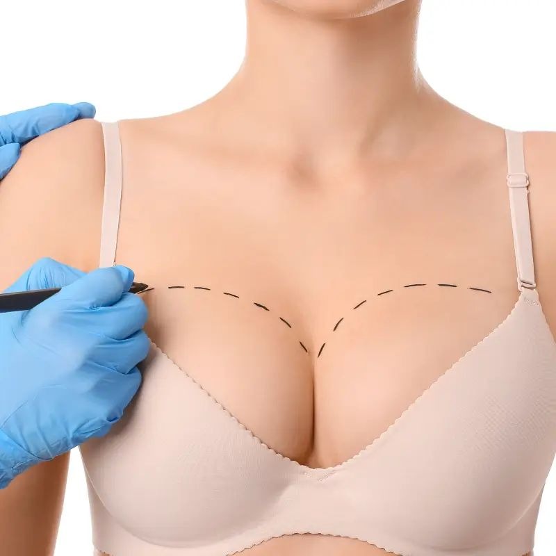Breast Augmentation